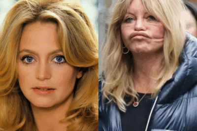 À 79 ans, le lifting “raté” de Goldie Hawn fait le tour du monde : L’avant/après qui choque